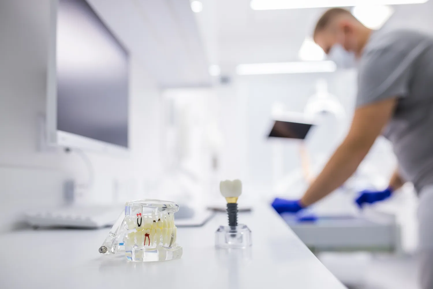 Czy implanty trzeba wymieniać?