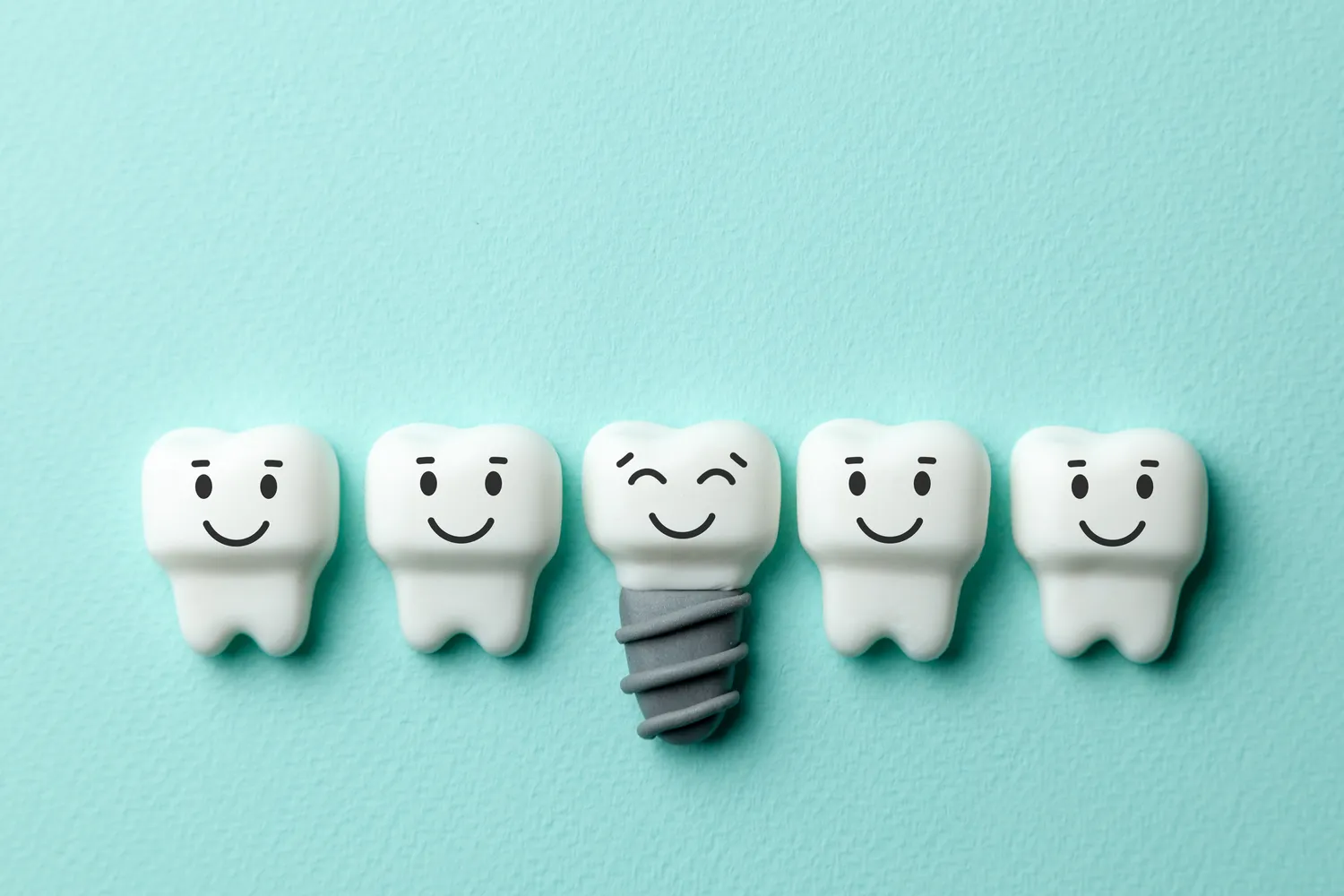 Ile kosztują implanty zębowe?