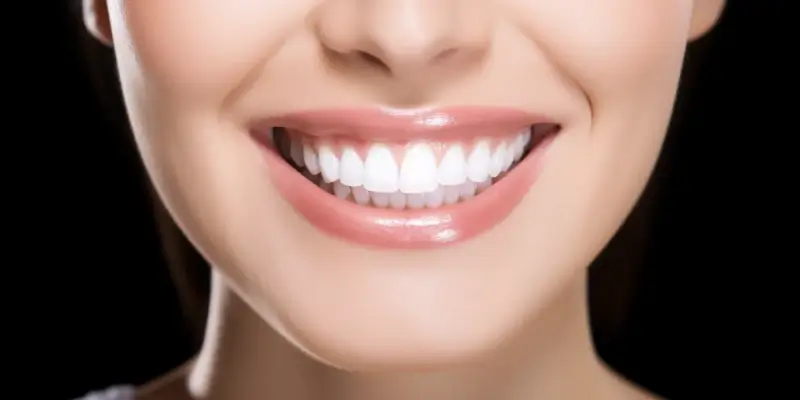 Piękny uśmiech w 5 minut. Czy warto założyć licówki?